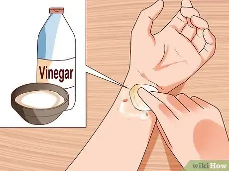 Imagem intitulada Remove Warts Naturally Using Garlic Step 8