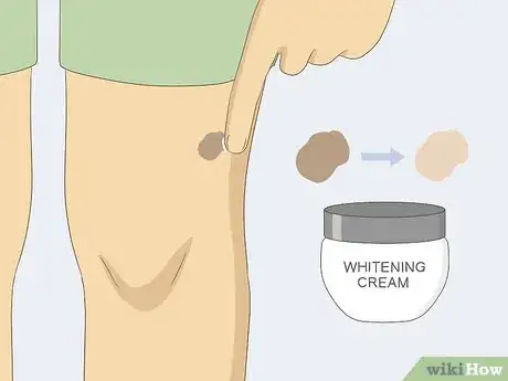 Imagem intitulada Remove Moles Quickly Step 18