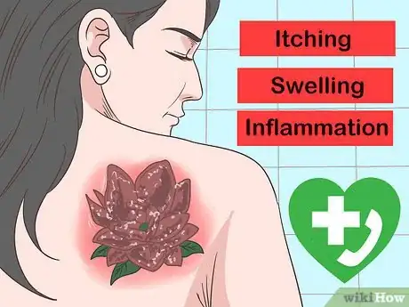 Imagem intitulada Treat an Infected Tattoo Step 10