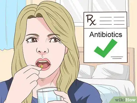 Imagem intitulada Get Rid of an Abscess Step 12