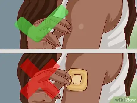 Imagem intitulada Read a Tuberculosis Skin Test Step 2