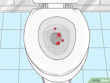 Imagem intitulada Stop Rectal Bleeding Step 2