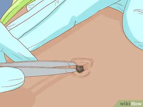 Imagem intitulada Clean Your Belly Button Step 10