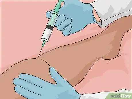 Imagem intitulada Remove Scars on Legs Step 19