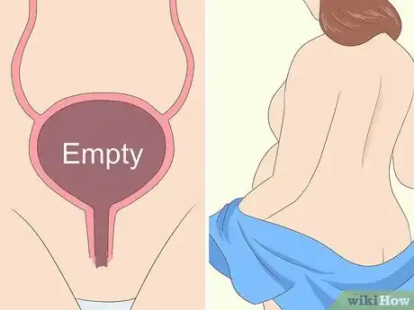 Imagem intitulada Measure Fundal Height Step 9