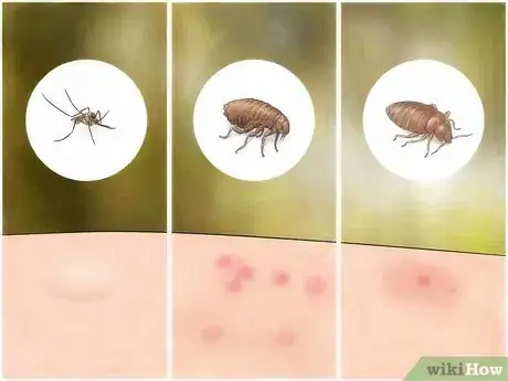 Imagem intitulada Identify Insect Bites Step 2