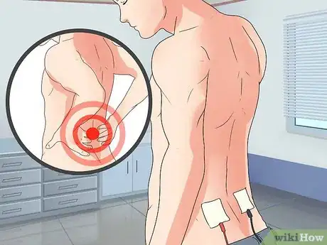 Imagem intitulada Place Electrodes for a Tens Unit Step 10