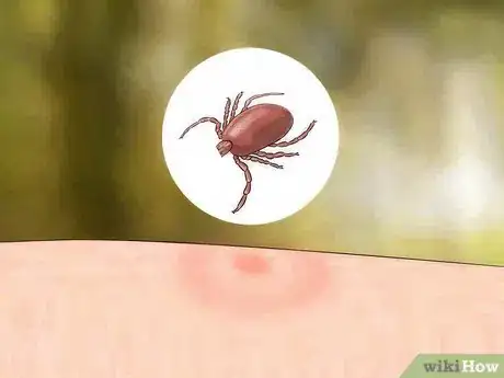 Imagem intitulada Identify Insect Bites Step 5