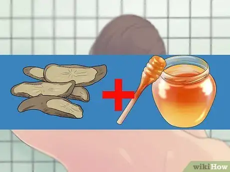 Imagem intitulada Remove a Sebaceous Cyst Step 9