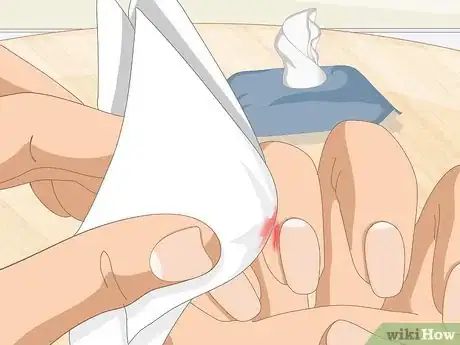 Imagem intitulada Heal Cuticles Step 2