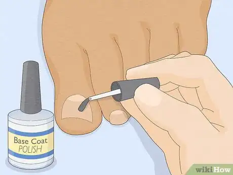 Imagem intitulada Have Pretty Toenails Step 11