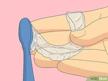 Imagem intitulada Clean Invisalign Step 2