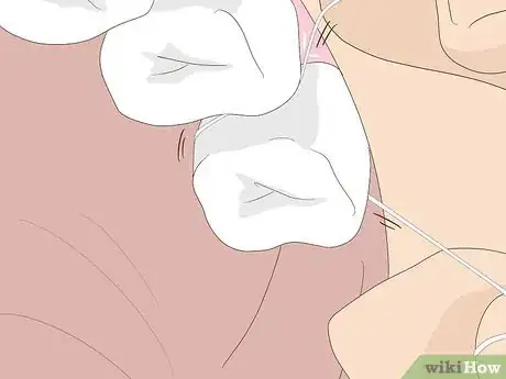 Imagem intitulada Floss Step 9