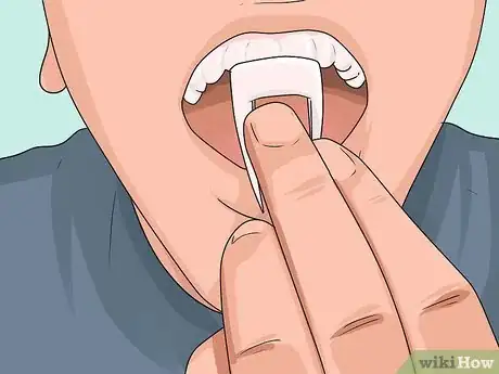 Imagem intitulada Make Vampire Fangs Step 12