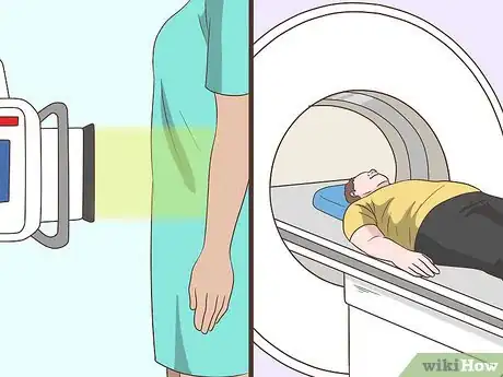 Imagem intitulada Detect Rectal Cancer Step 9