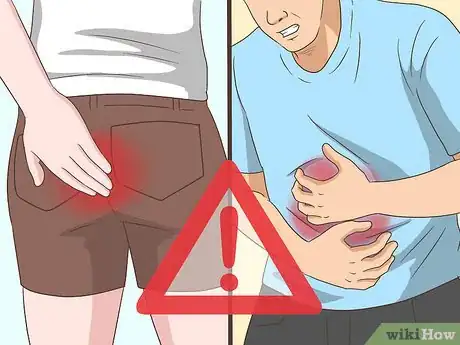 Imagem intitulada Detect Rectal Cancer Step 3