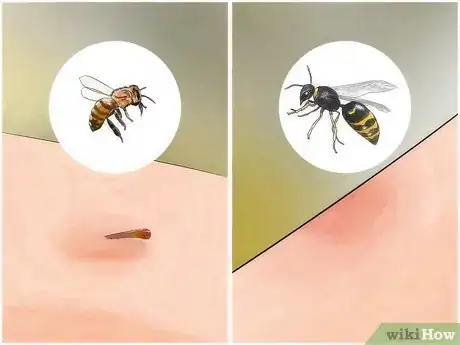 Imagem intitulada Identify Insect Bites Step 4