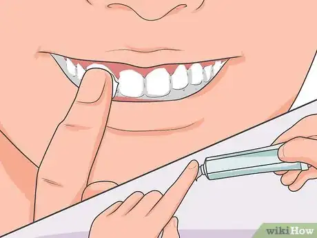 Imagem intitulada Cure a Toothache Step 3