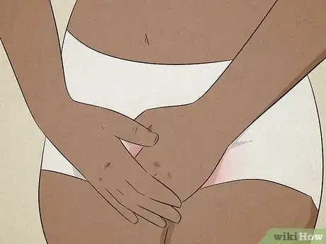 Imagem intitulada Get Rid of a Bartholin Cyst Step 9