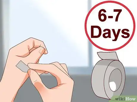 Imagem intitulada Remove Warts Naturally Using Garlic Step 15