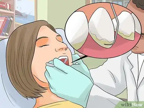 Imagem intitulada Stop Itchy Gums Step 12