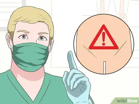Imagem intitulada Detect Rectal Cancer Step 6