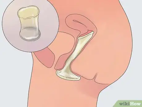 Imagem intitulada Avoid Getting HIV Step 8