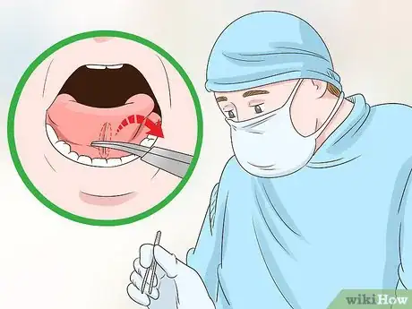 Imagem intitulada Get a Longer Tongue Step 5