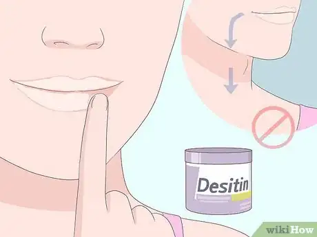 Imagem intitulada Cure Angular Cheilitis Step 4