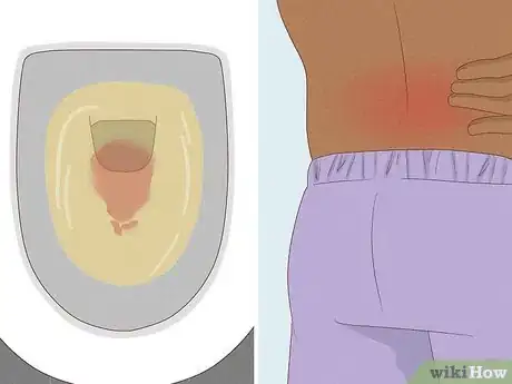 Imagem intitulada Check Your Prostate Step 2