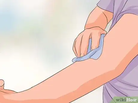 Imagem intitulada Get an Injection Without It Hurting Step 10