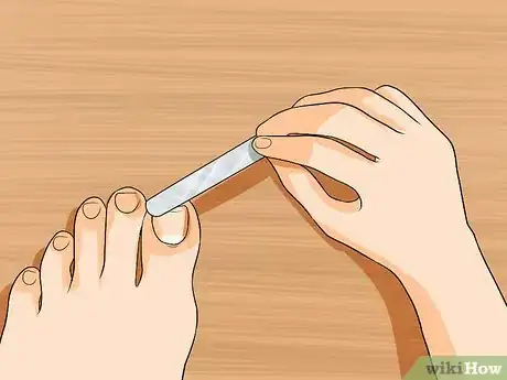 Imagem intitulada Get Rid of Yellow Toenails Step 15