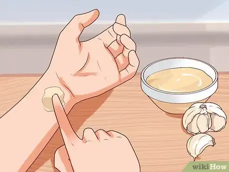 Imagem intitulada Remove Warts Naturally Using Garlic Step 1