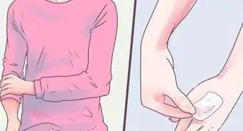 Tratar Moluscos Contagiosos Constrangedores