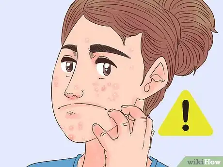 Imagem intitulada Use Bio Oil Step 5