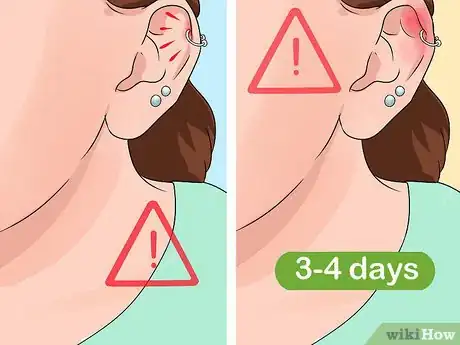 Imagem intitulada Clean a Cartilage Piercing Step 10