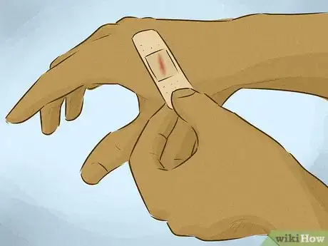 Imagem intitulada Stop Bleeding Step 14