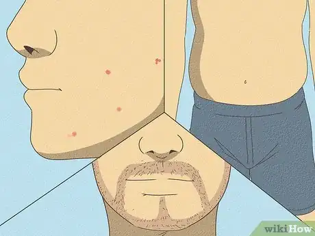 Imagem intitulada Lower Testosterone Levels Step 12