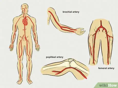 Imagem intitulada Stop Bleeding Step 21