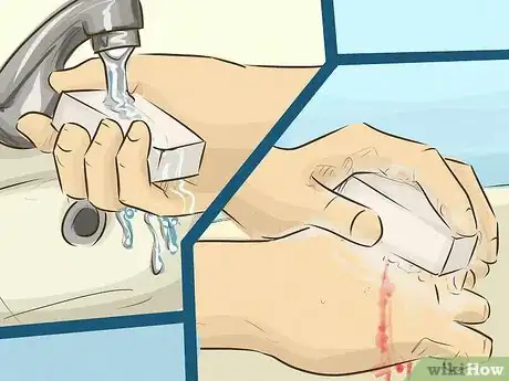 Imagem intitulada Stop Bleeding Step 12