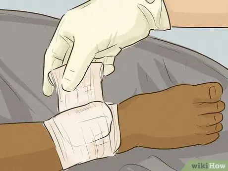 Imagem intitulada Stop Bleeding Step 20