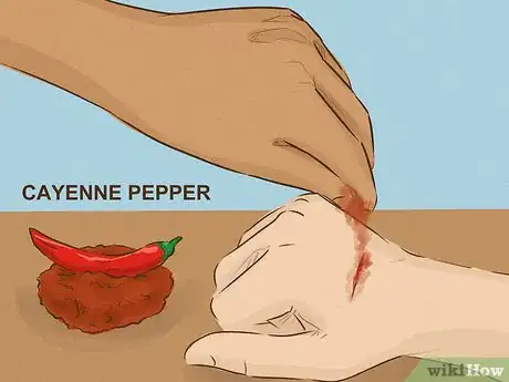 Imagem intitulada Stop Bleeding Step 11