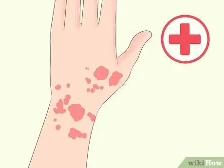 Imagem intitulada Lower CPK Levels Naturally Step 16