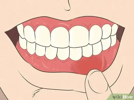 Imagem intitulada Fix Nicotine Stained Teeth Step 12