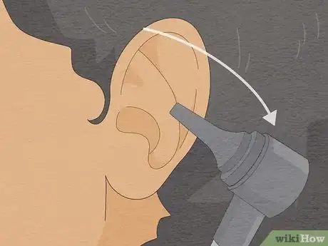 Imagem intitulada Look Into Your Own Ear Step 12
