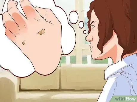 Imagem intitulada Remove Warts Naturally Using Garlic Step 18