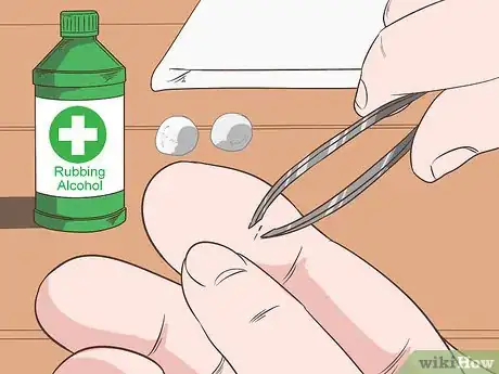 Imagem intitulada Remove a Deep Splinter Step 1