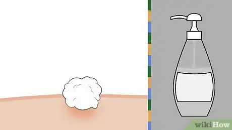 Imagem intitulada Remove a Tick Step 10