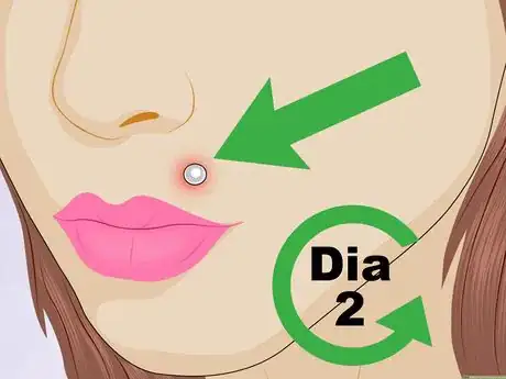 Imagem intitulada Tell if a Piercing Is Infected Step 1