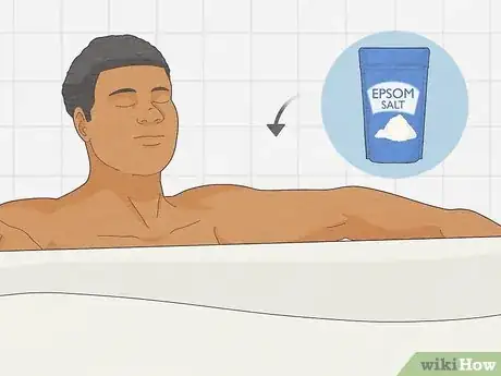 Imagem intitulada Cure Balanitis Step 2